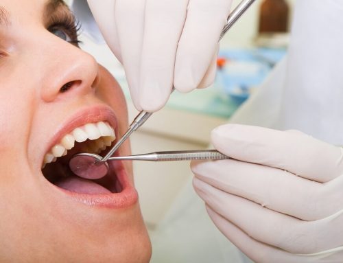 Implanty zębów – jaki materiał wybrać na koronę?